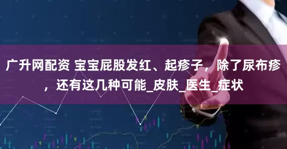 广升网配资 宝宝屁股发红、起疹子，除了尿布疹，还有这几种可能_皮肤_医生_症状
